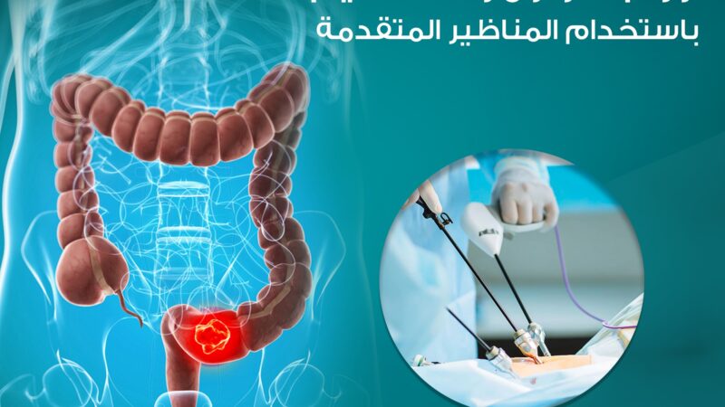 The latest technologies for treating colorectal tumors