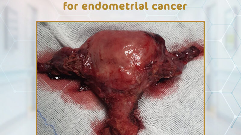 Laparoscopic hysterectomy for endometrial cancer