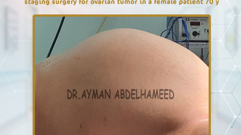 Success Total abdominal hysterectomy