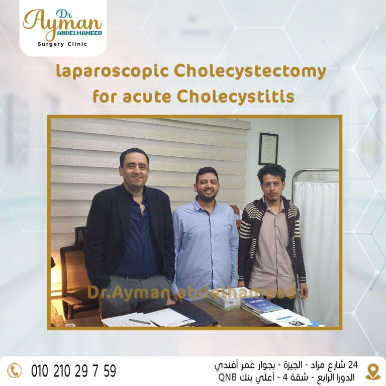 Read more about the article laparoscopic Cholecystectomy for acute Cholecystitis